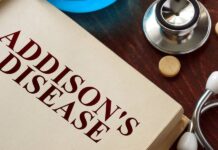 What is Addison’s Disease? – HealthyWomen
