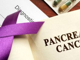 Información confirmada del cáncer pancreático