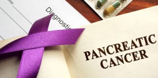 Información confirmada del cáncer pancreático