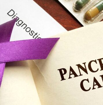 Información confirmada del cáncer pancreático