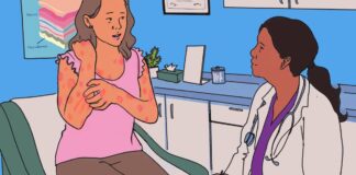 Holly has chronic spontaneous urticaria